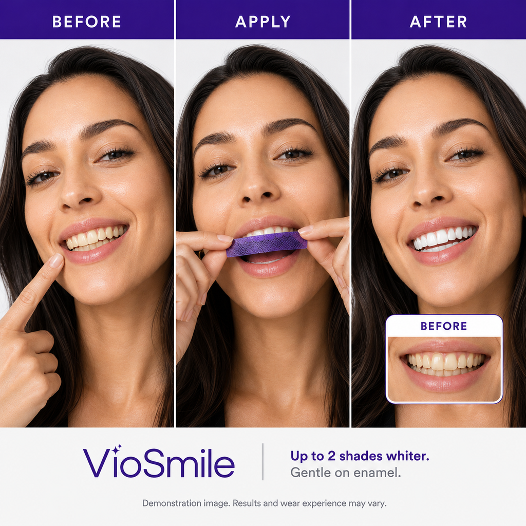 Purple Whitening Strips