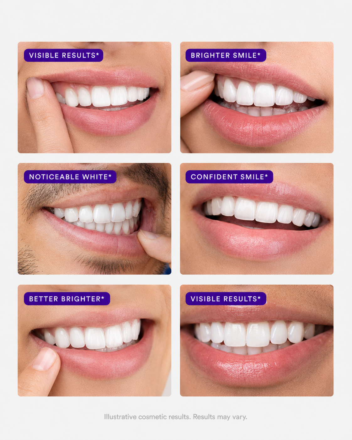 Purple Whitening Strips